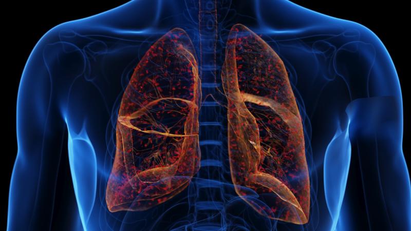 ¿Qué es la peste pulmonar y cuán peligrosa es?